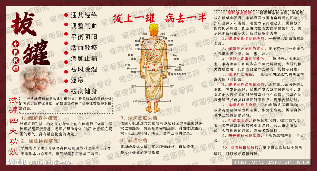 中醫(yī)拔罐展板海報