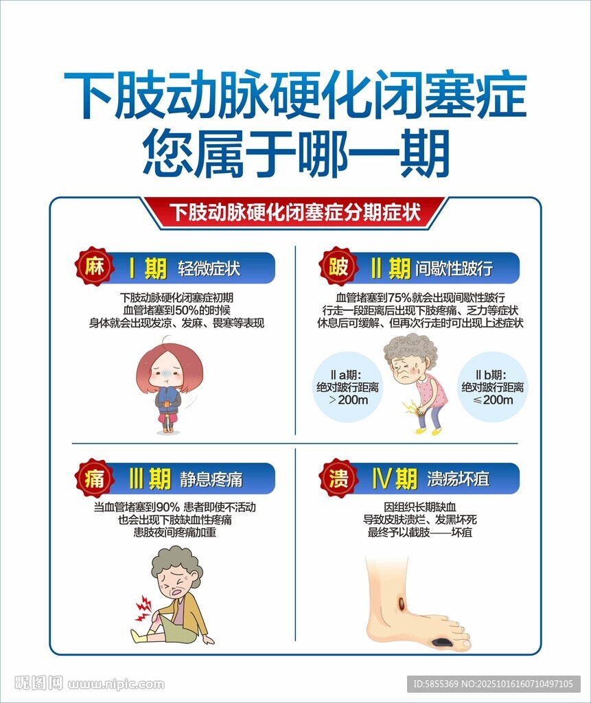 動(dòng)脈硬化閉塞癥