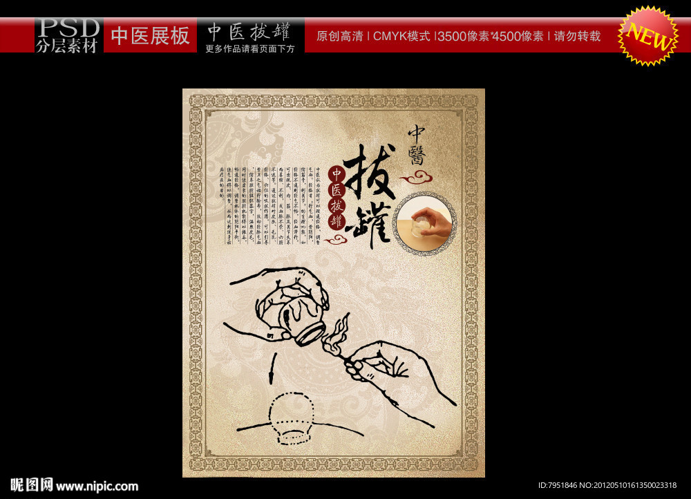 中医拔罐