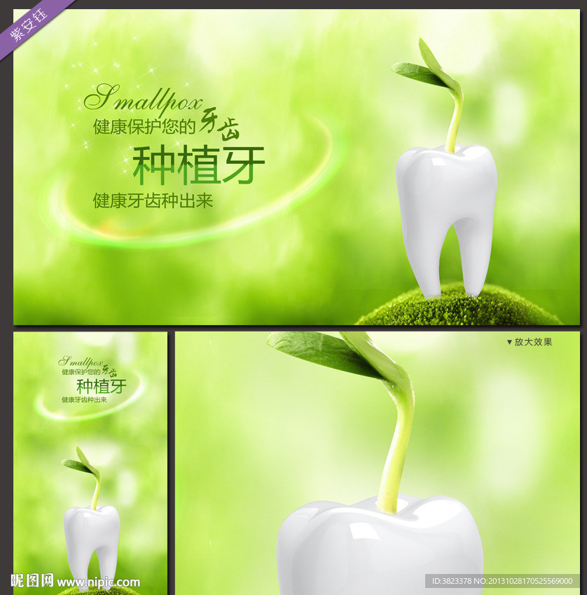 牙科 种植牙