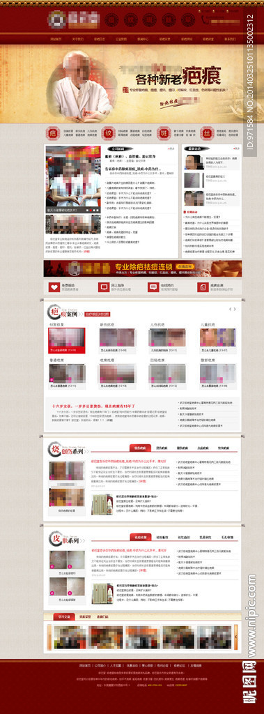 疤痕网站（无代码）