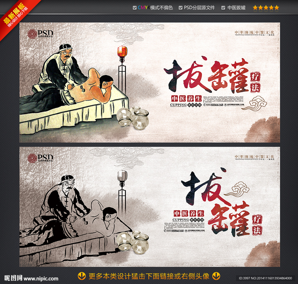 中医拔罐