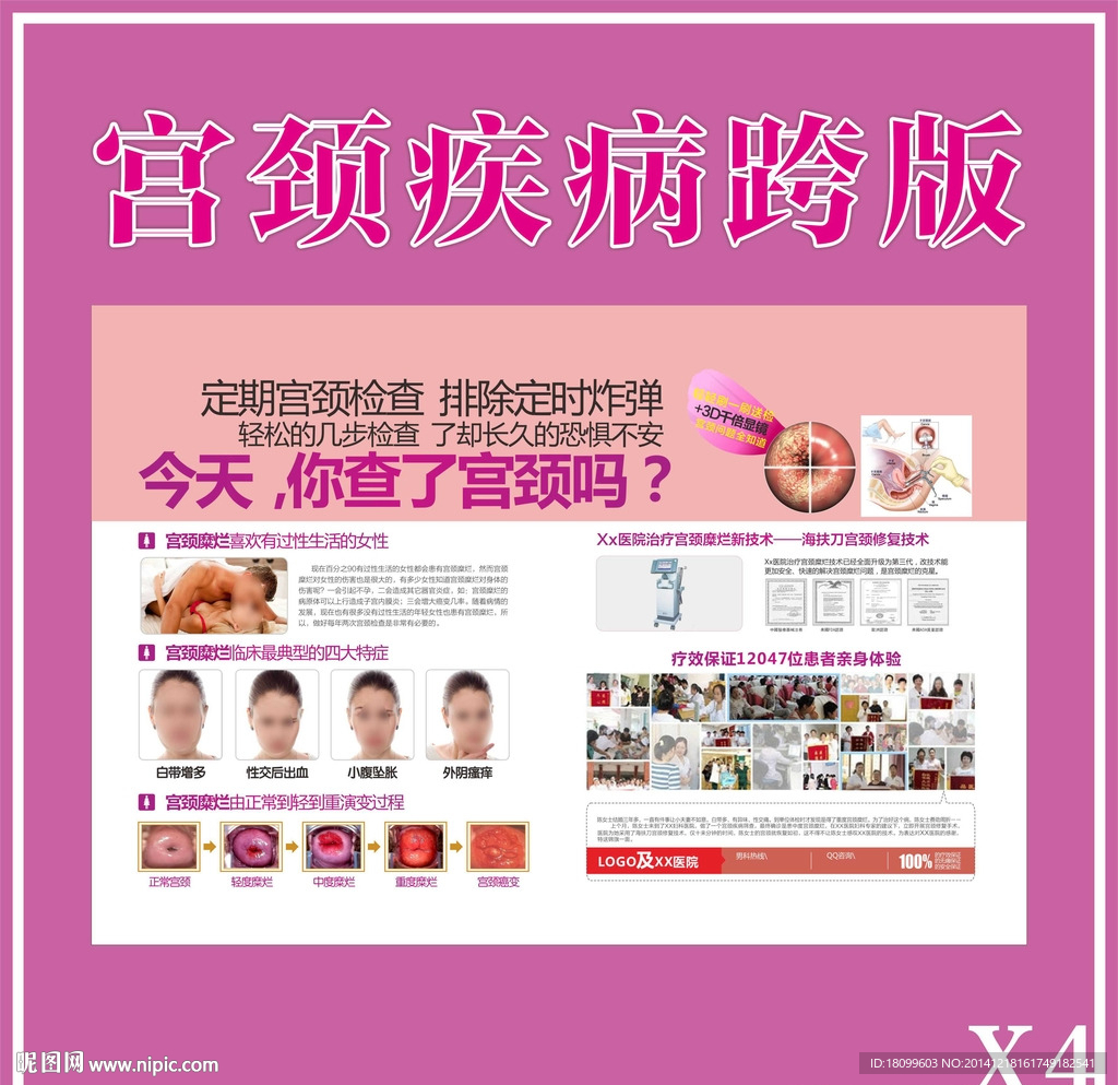 宫颈疾病