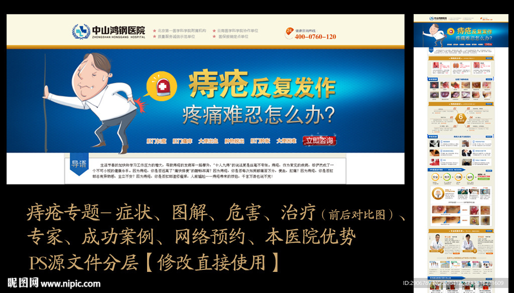 痔疮专题