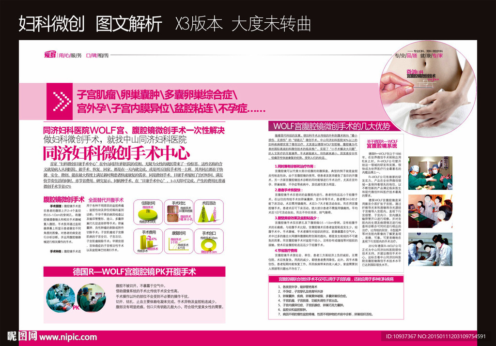 妇科微创 微创 宫腔镜 腹腔镜