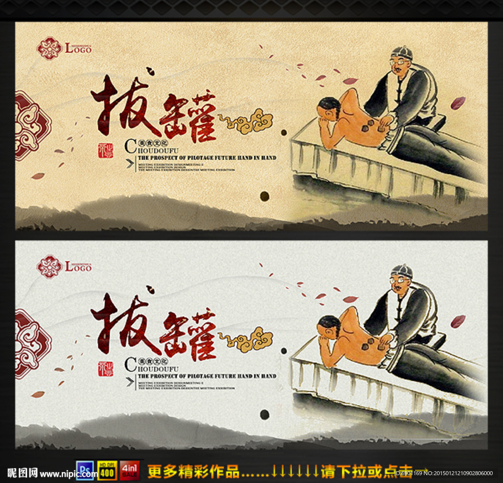 拔罐