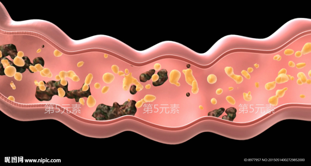 肠道积累毒素
