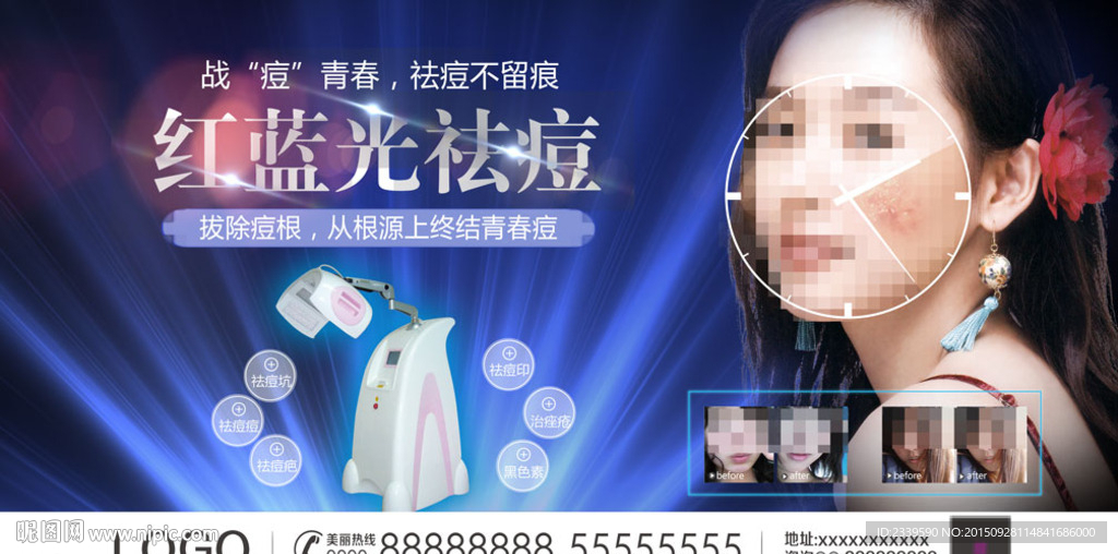 红蓝光祛痘