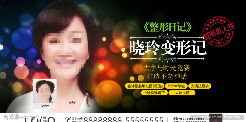 整形日记
