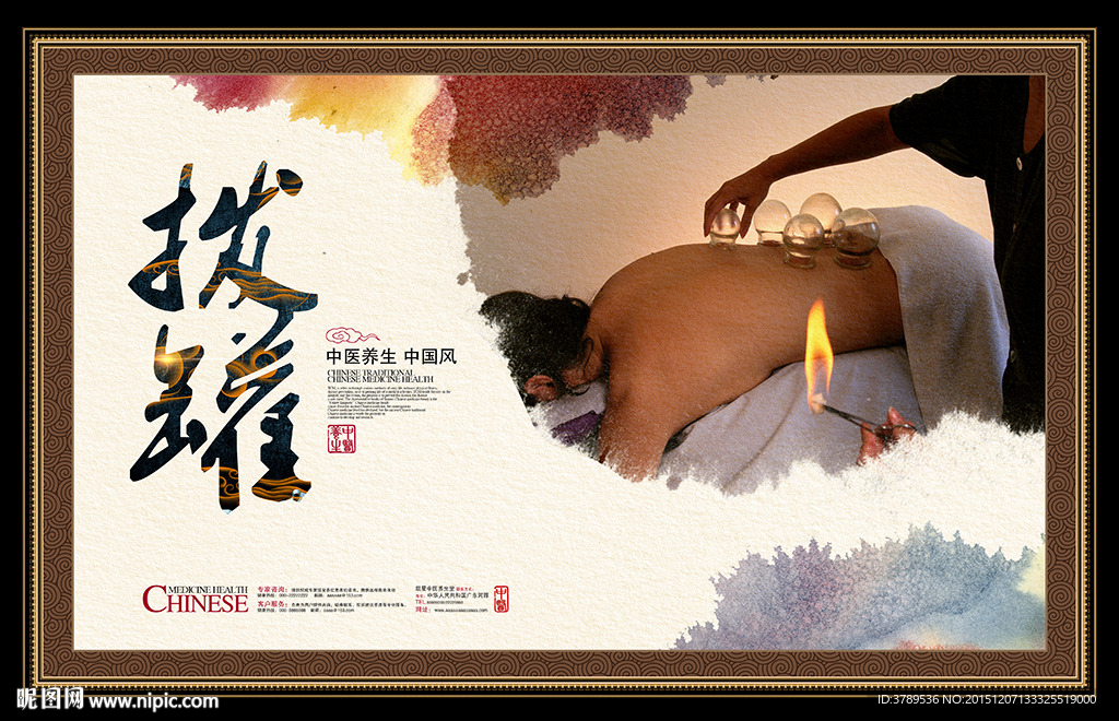 中医拔罐
