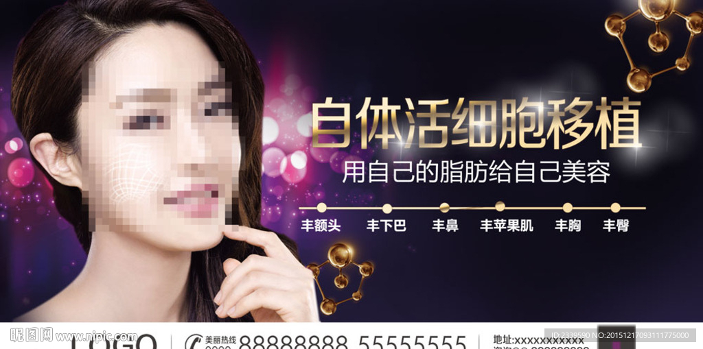 自体移植