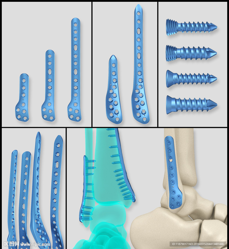 医疗器械 医疗钢板