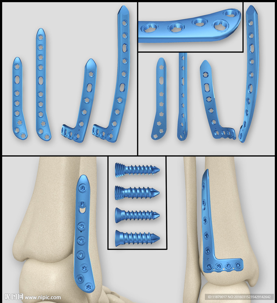医疗器械 医疗钢板