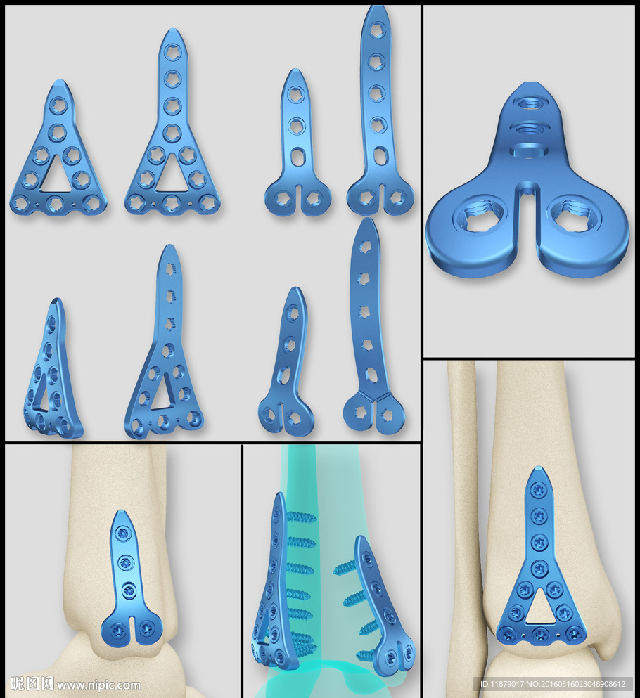 医疗器械 医疗钢板