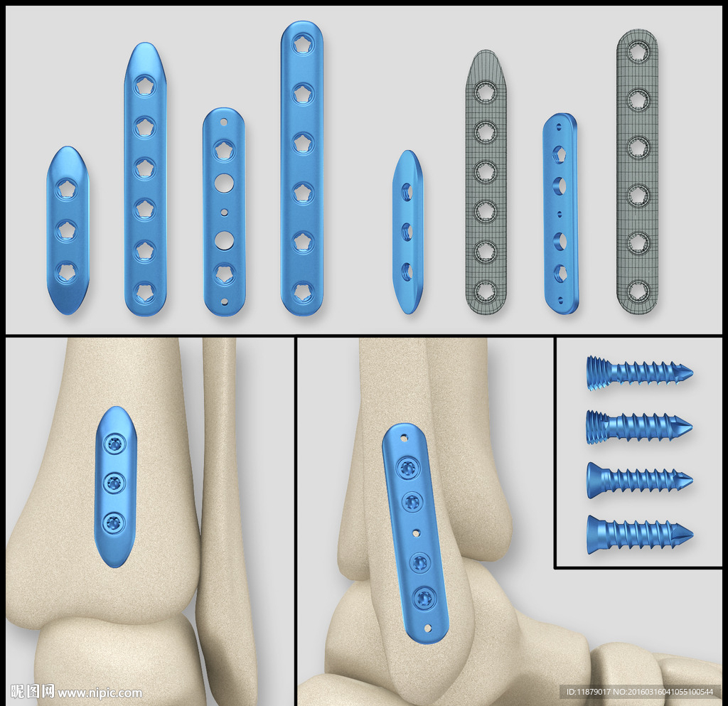 医疗器械 医疗钢板