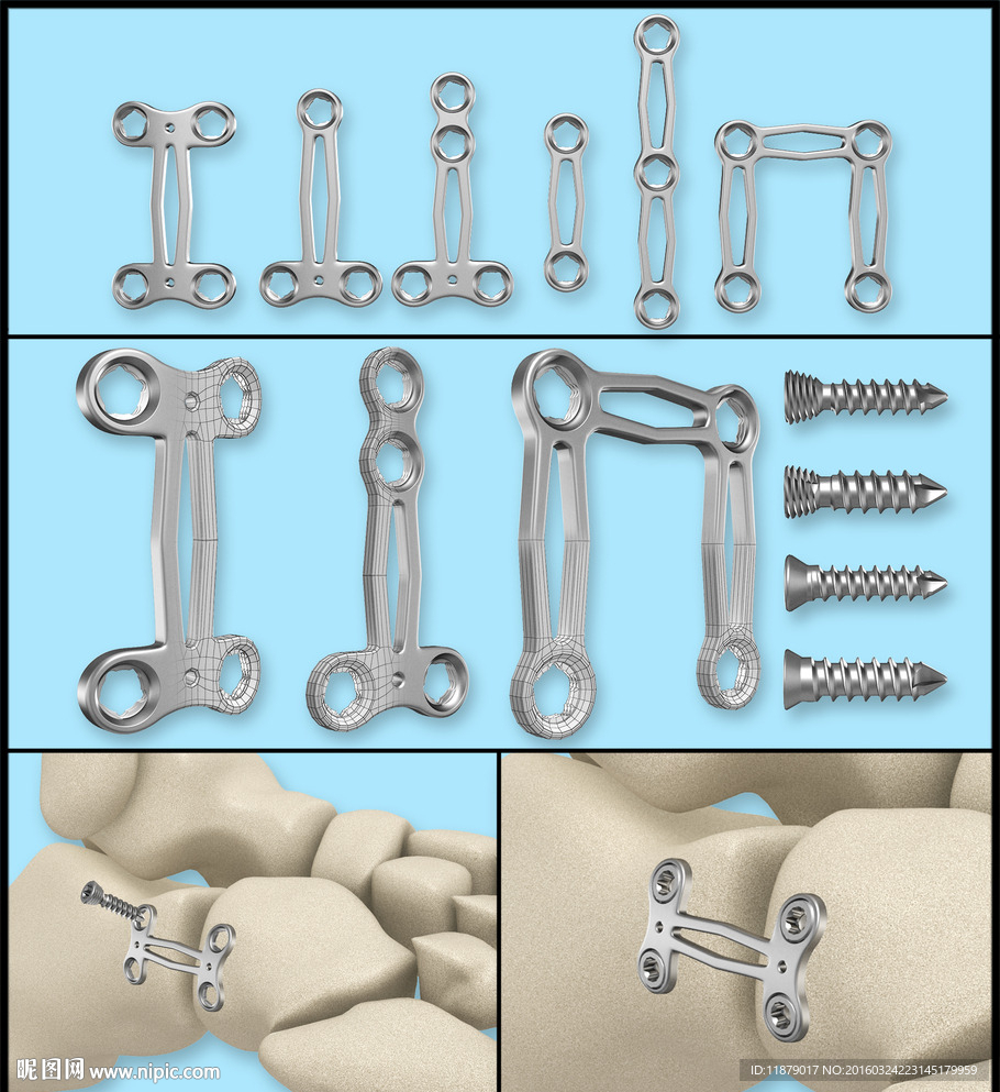 医疗器械 医疗钢板