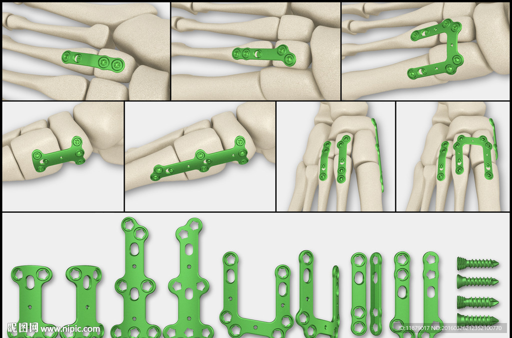 医疗器械 医疗钢板