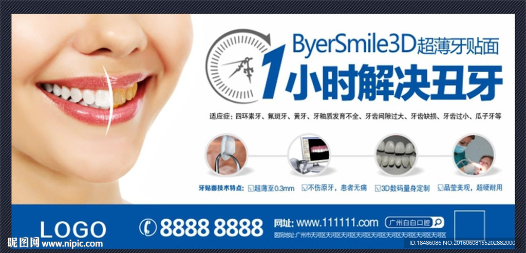 3D牙贴面 牙齿美白