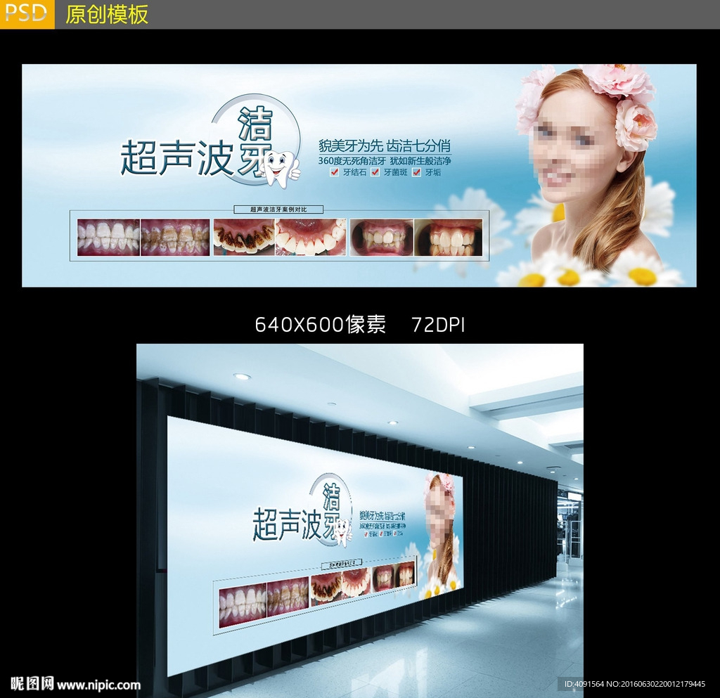 洁牙户外广告设计