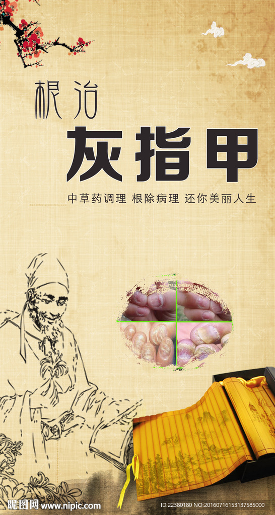 灰指甲