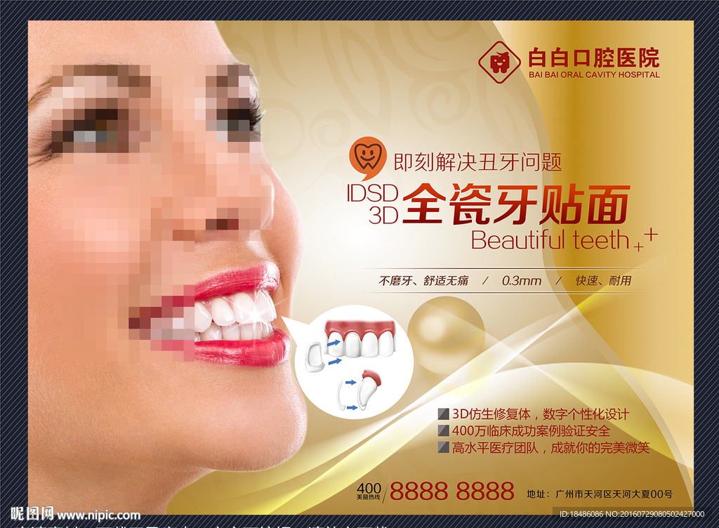 牙齿美白 牙贴面