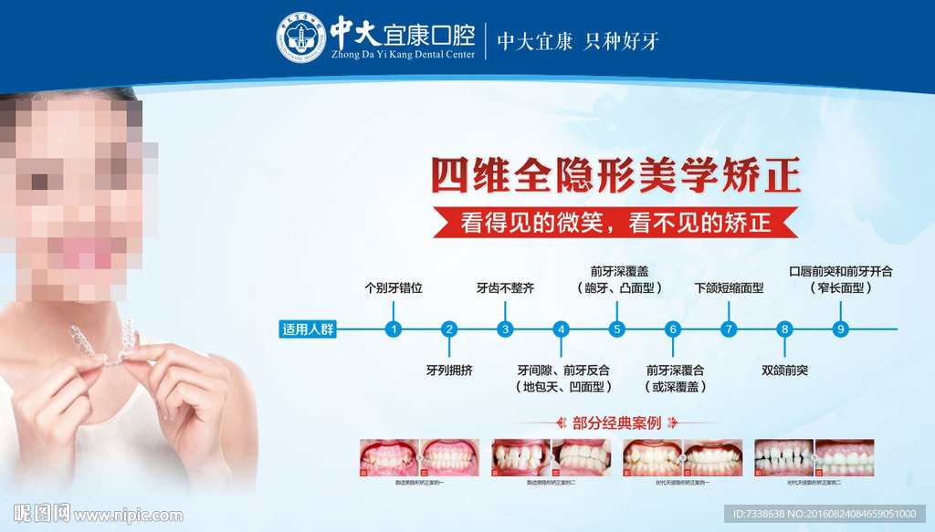 隐适美牙齿隐形矫正