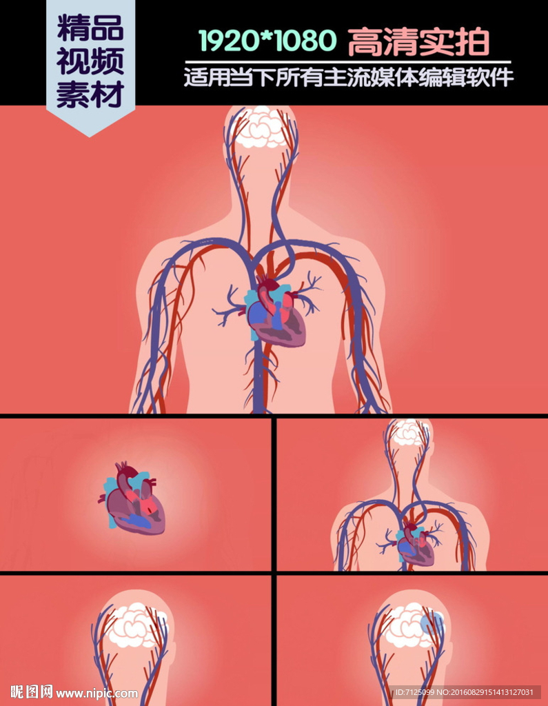 心血管疾病中风医学演示动画