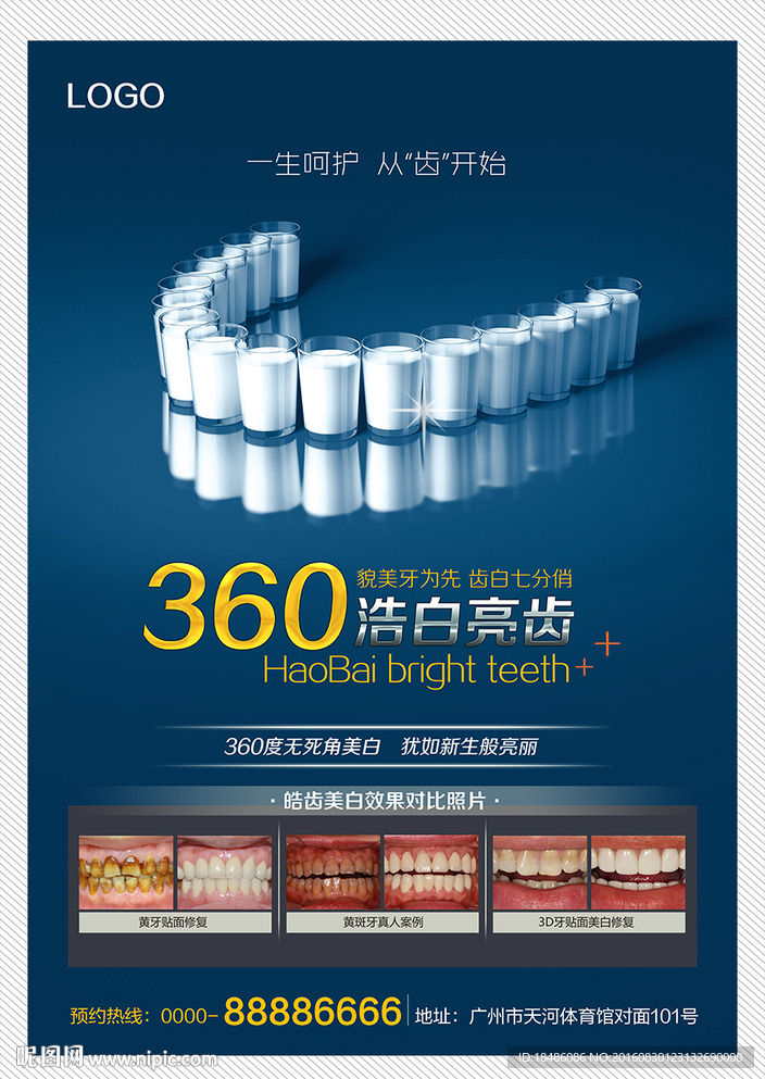 牙齿美白