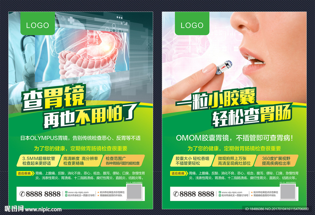 胃肠检查 胶囊胃镜