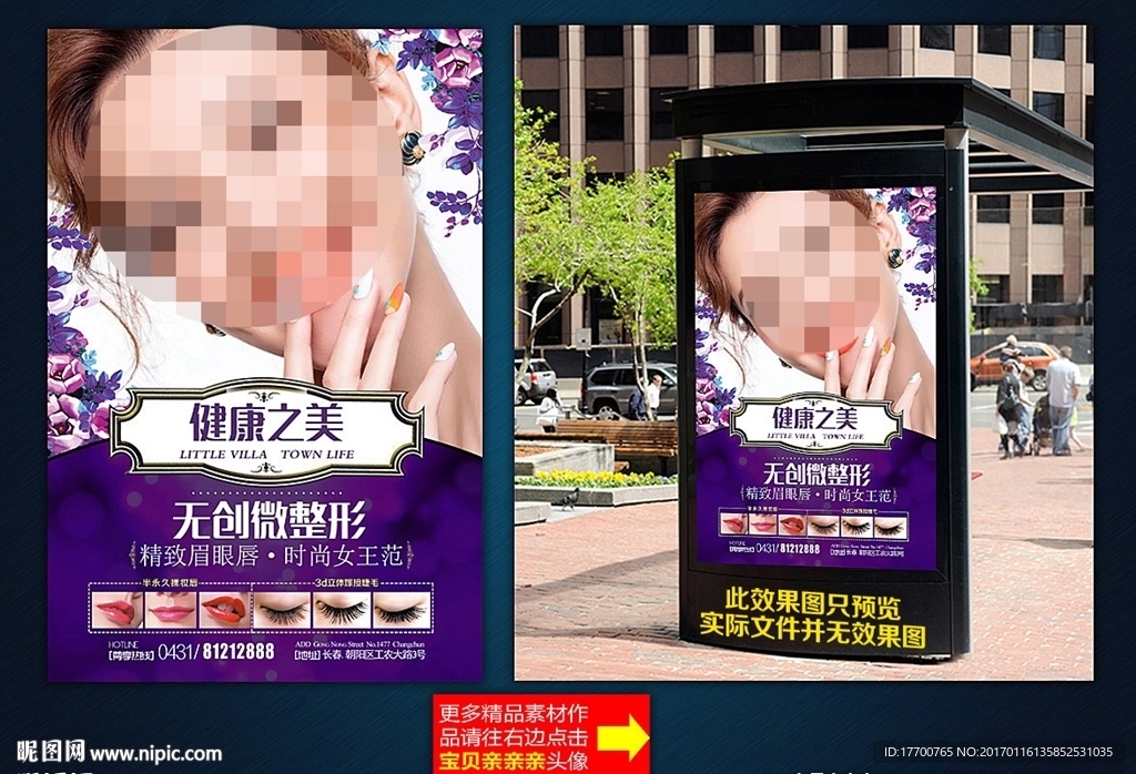 整形