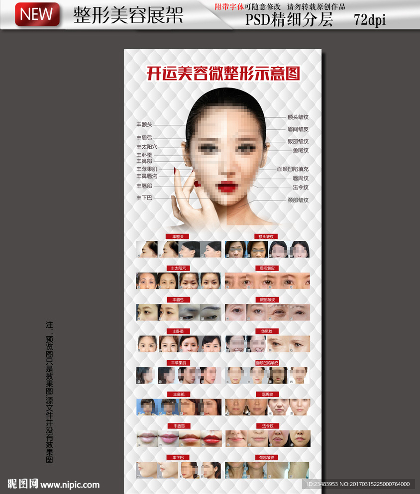 美容微整形示意图海报展架