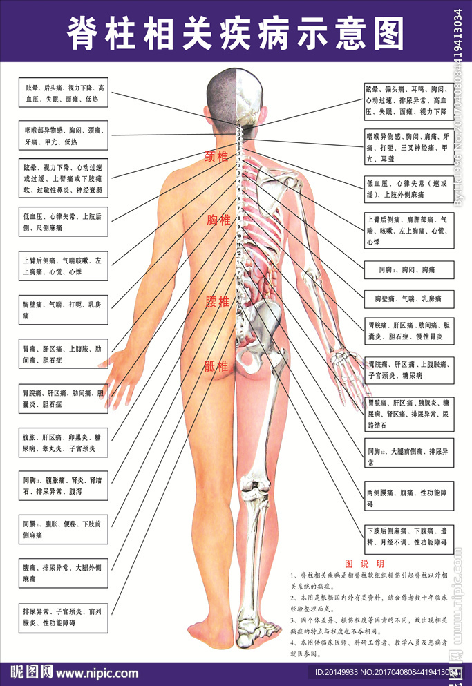 脊柱相关疾病示意图