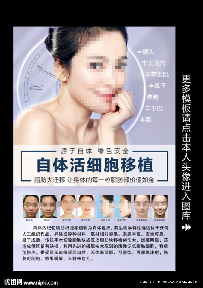 自体活细胞移植术写真海报挂画