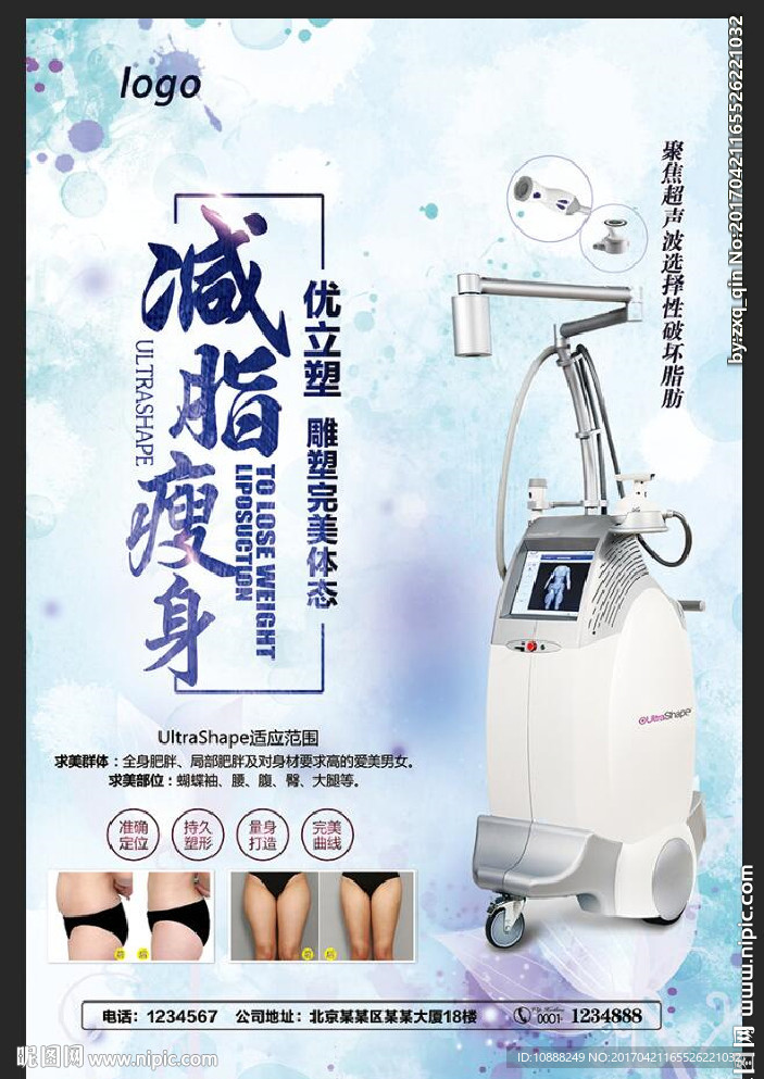 优立塑 减肥