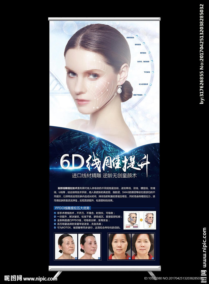 线雕提拉展架