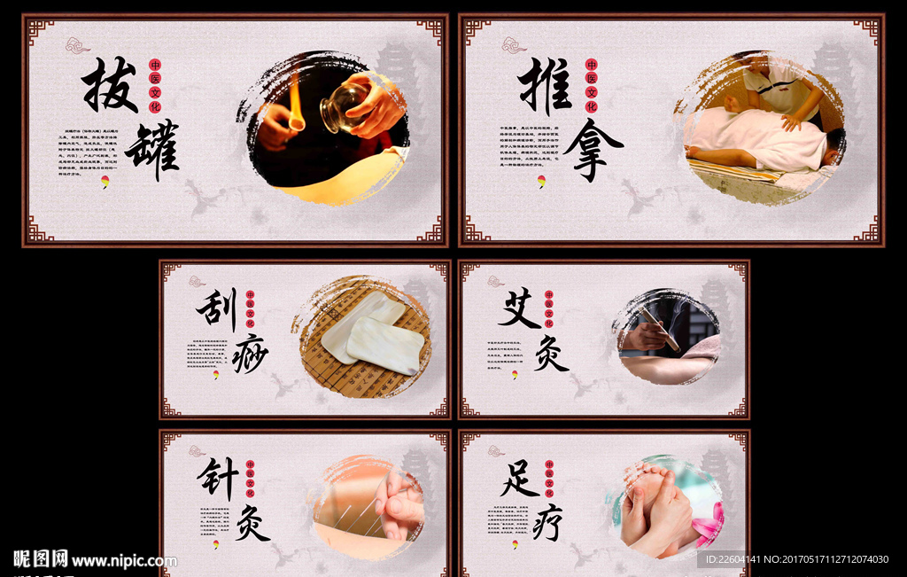 中医艾灸针灸推拿拔罐刮痧足疗