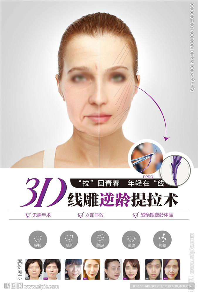 3D 线雕逆龄提拉术