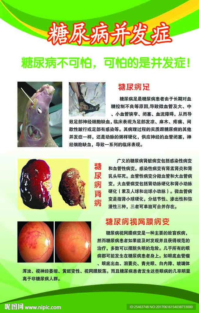 糖尿病并发症