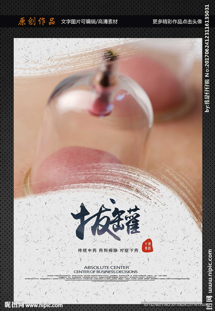 拔罐