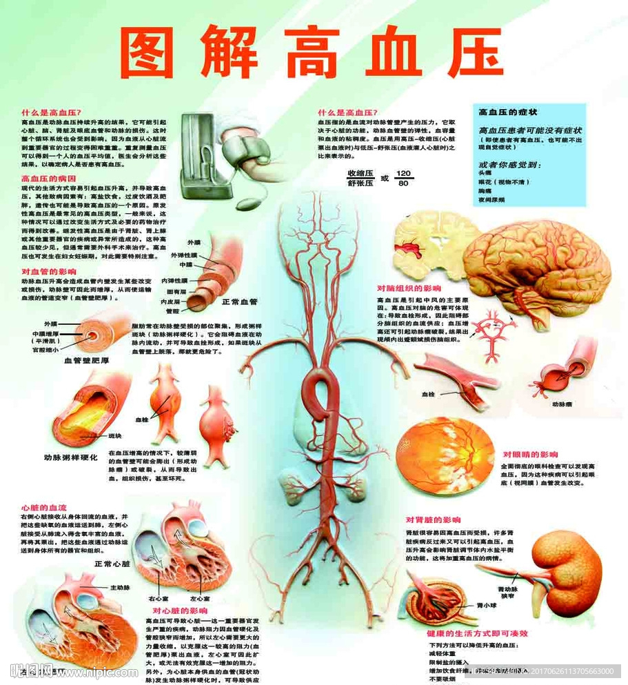 图解高血压
