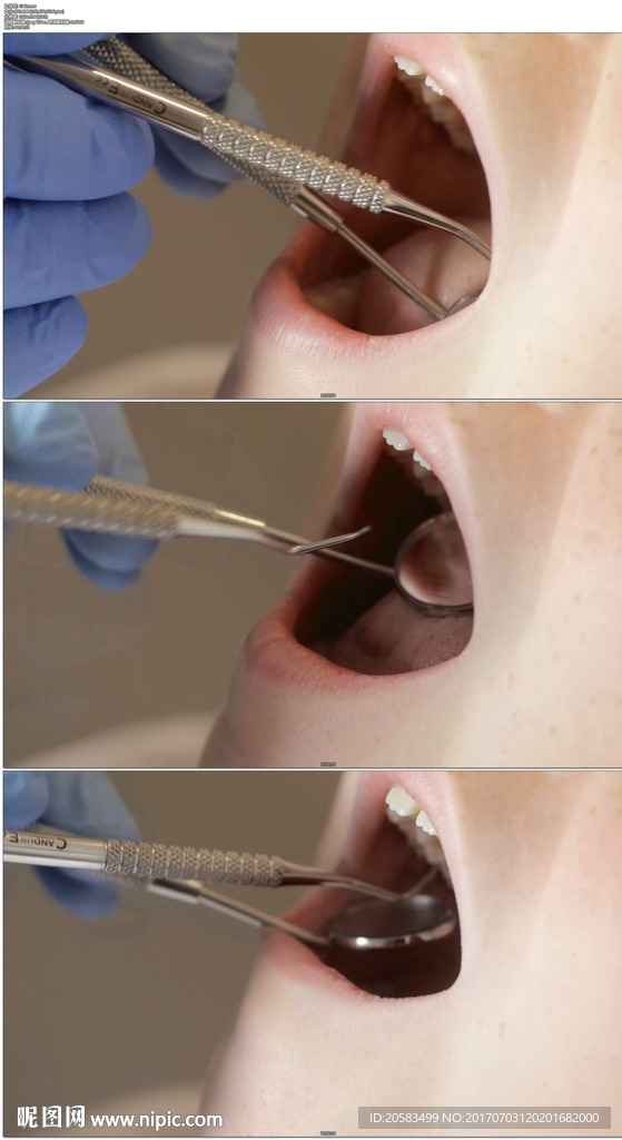 牙医检查口腔