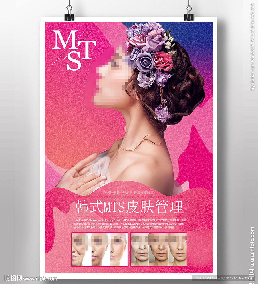 MTS皮肤管理