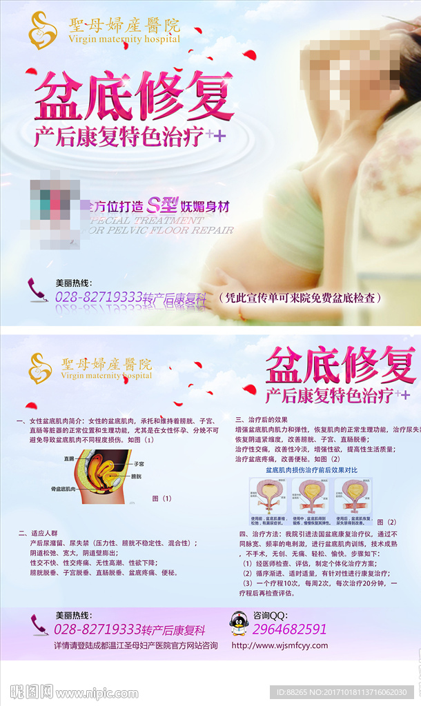 盆底修复DM单