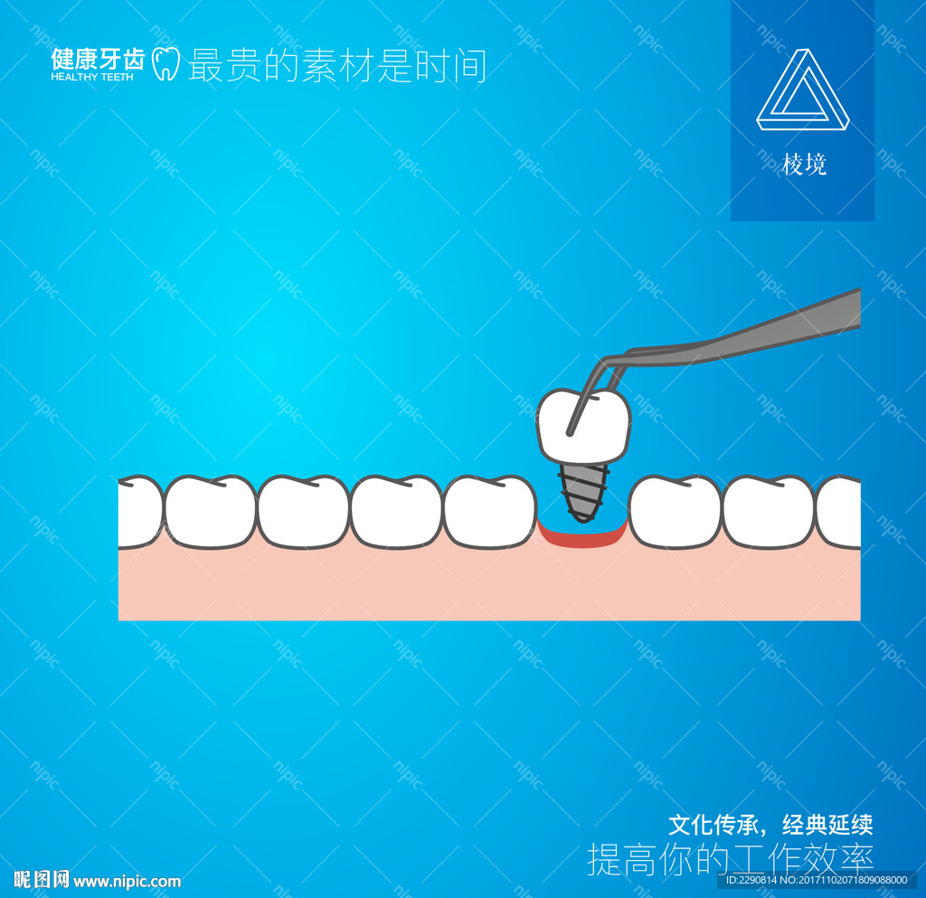 牙齿种植