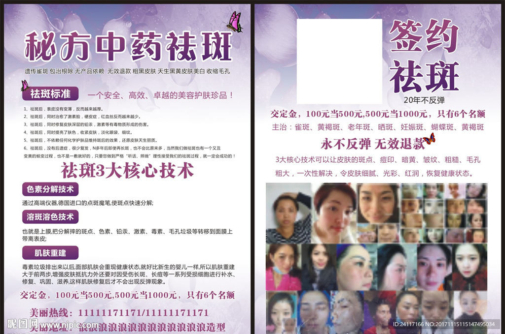 秘方中药祛斑