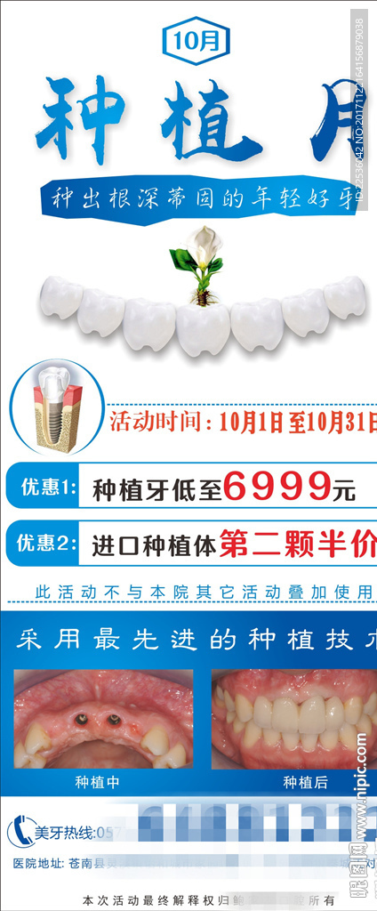 种植展架