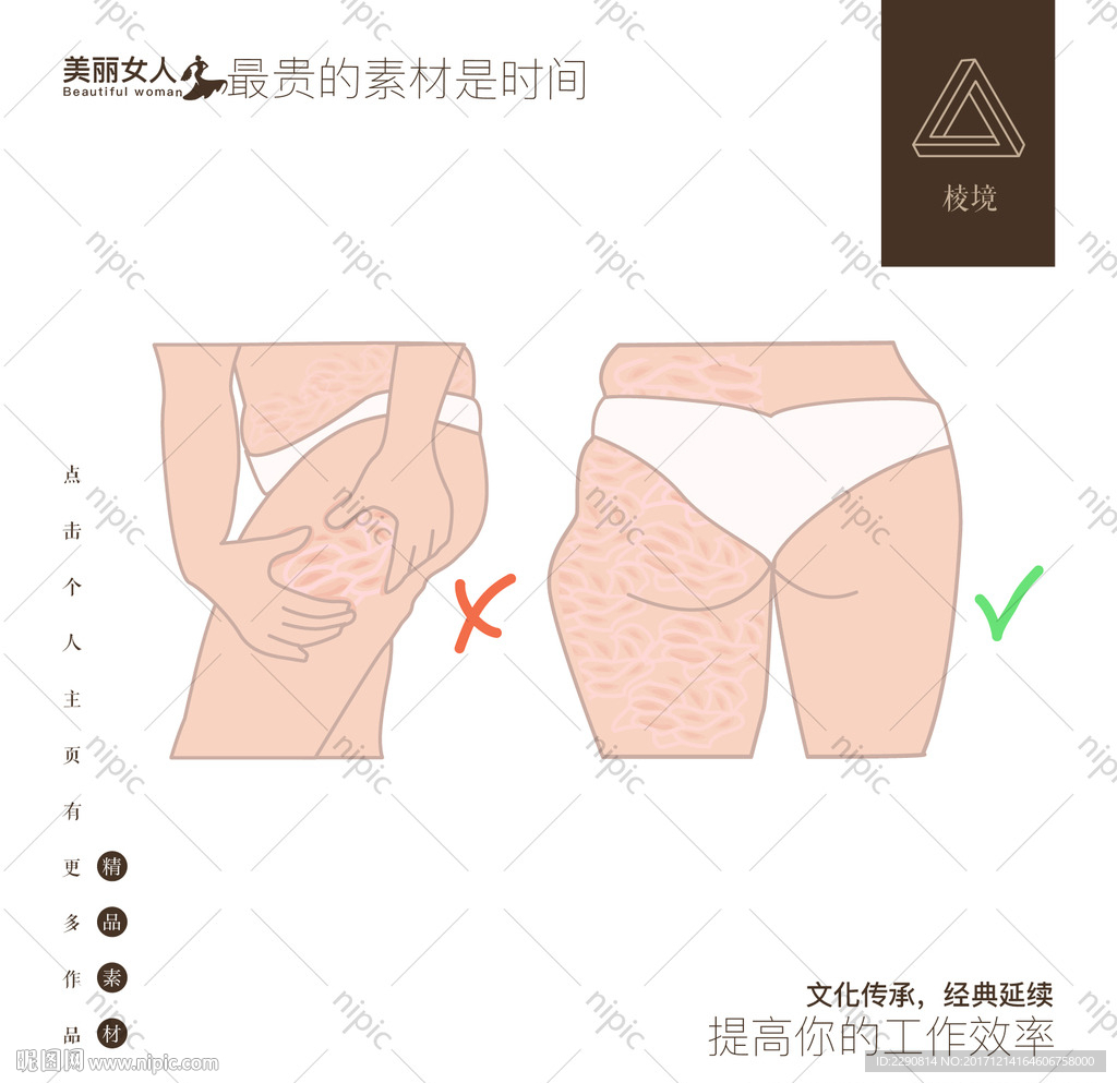 妊娠纹