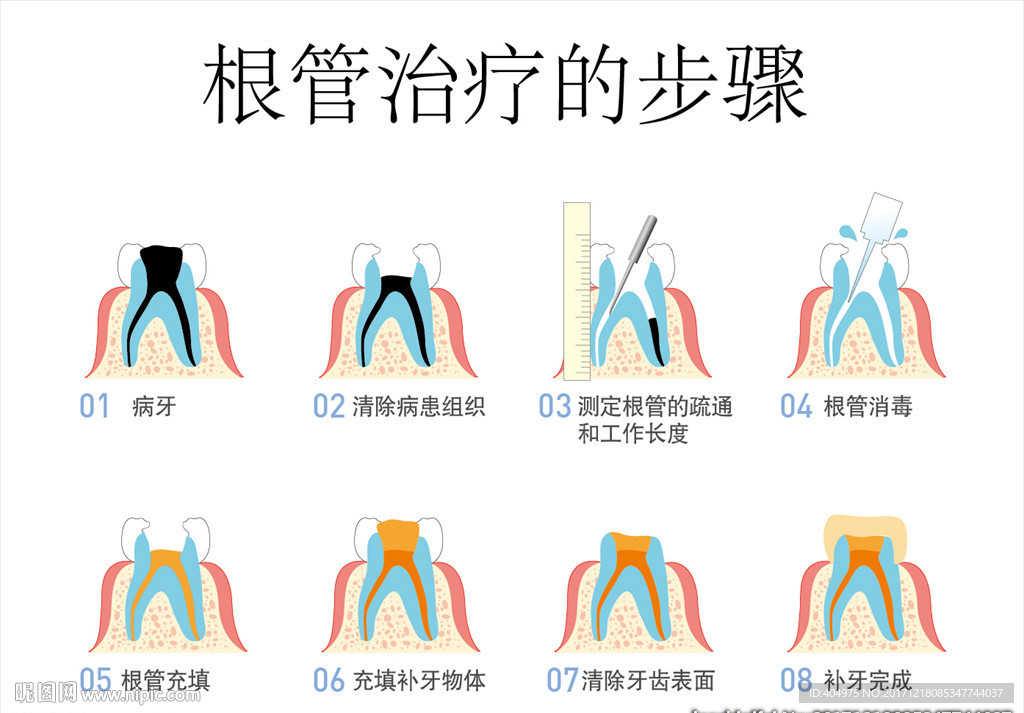 5)颜色:cmyk10元(cny)举报收藏立即下载×关 键 词:根管治疗 卡通牙齿