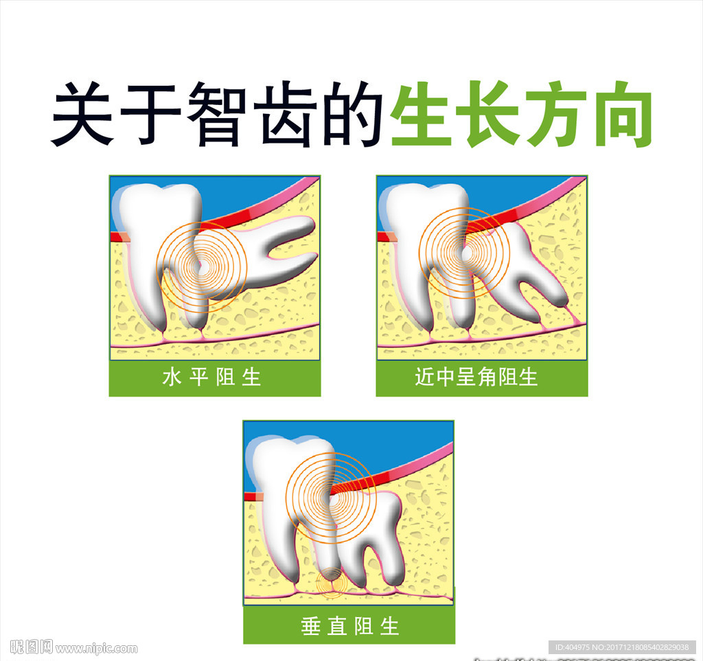 智齿的生长方向