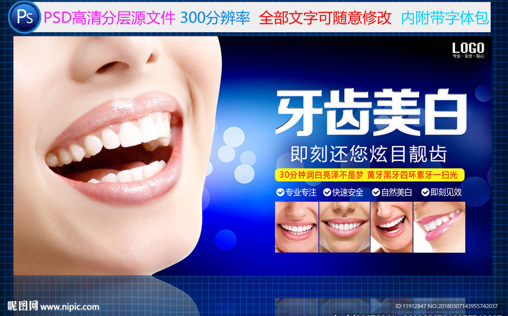 牙齿美白
